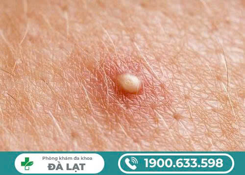 Hình ảnh minh họa